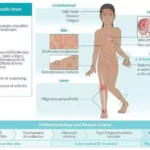 Signs and symptoms associated with rheumatological diseases in children