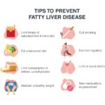 Dangers of fatty liver: 5 reasons it’s rising in young, lifestyle tweaks to reverse it