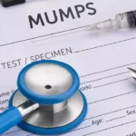 Mumps cases rise in Delhi, NCR: Watch out for these top symptoms
