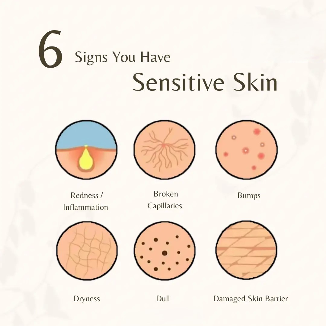 sensitive skin conditions in baby